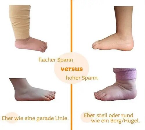Flacher v.s Hoher Spann - Fuß einschätzen