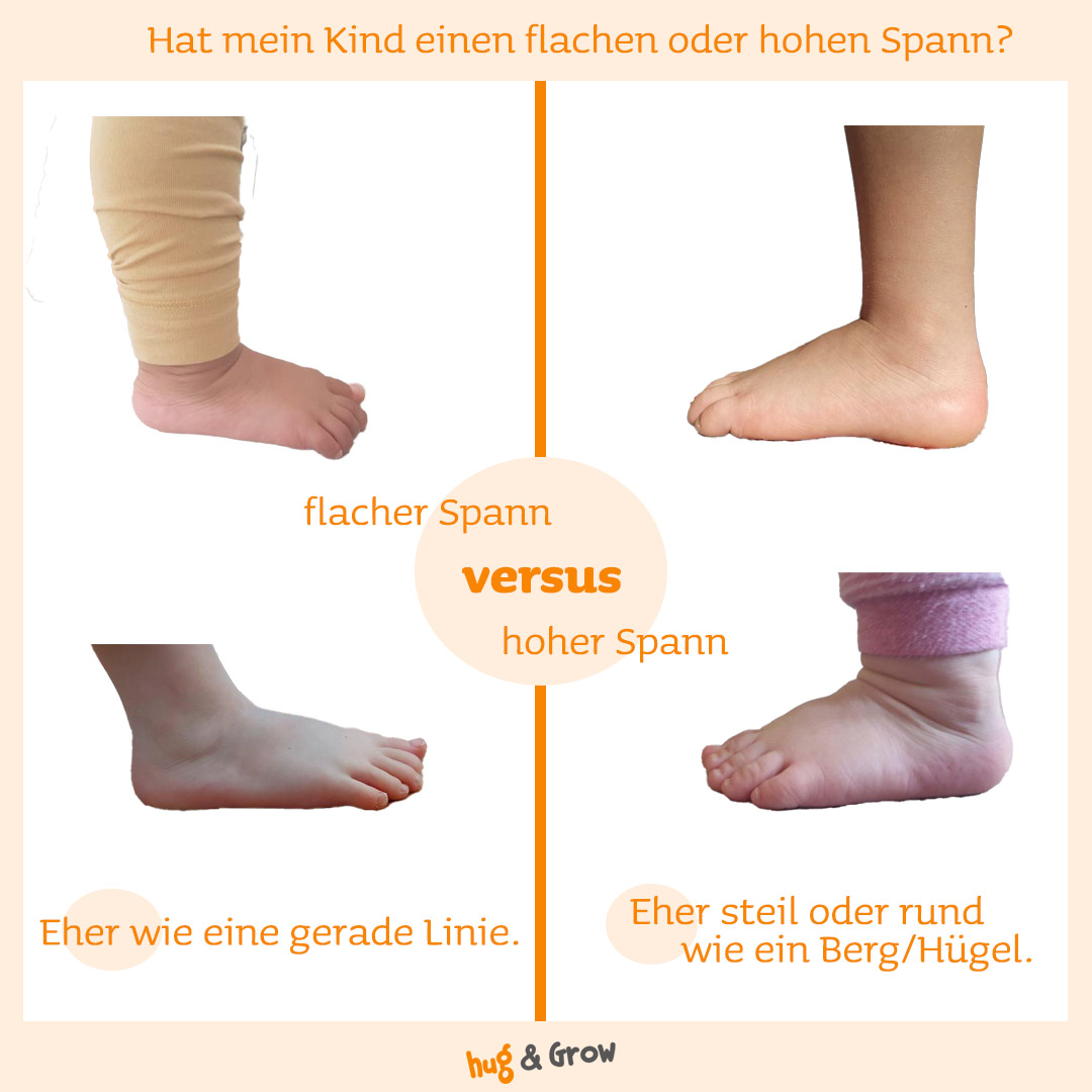 Grafik-flacher-oder-hoher-spann-kind-fuss-final.jpg
